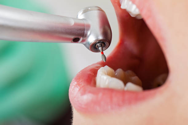 Best Pediatric Emergency Dentist in Danville, IN